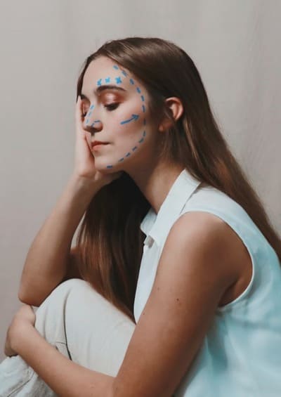 rhinoplastie secondaire